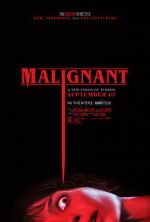 Watch Malignant Freemovieswatch