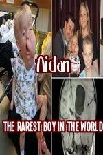 Watch Aidan The Rarest Boy In The World Freemovieswatch