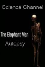 Watch Science Channel Elephant Man Autopsy Freemovieswatch