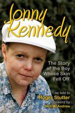 Watch The Boy Whose Skin Fell Off Freemovieswatch