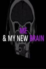 Watch Me & My New Brain Freemovieswatch