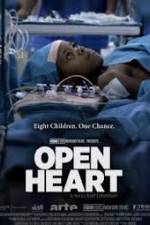Watch Open Heart Freemovieswatch
