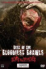 Watch TNA Wrestling: Best of the Bloodiest Brawls - Scars and Stitches Freemovieswatch
