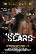 Watch Serbian Scars Freemovieswatch