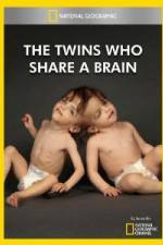 Watch National Geographic The Twins Who Share A Brain Freemovieswatch