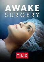 Watch Awake Surgery Freemovieswatch