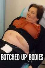 Watch Botched Up Bodies Freemovieswatch