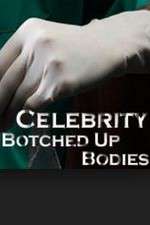 Watch Celebrity Botched Up Bodies Freemovieswatch